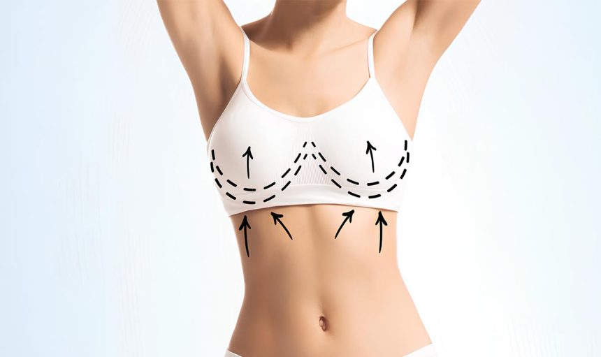 breast-lift