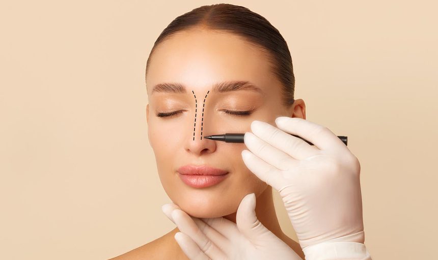 rhinoplasty