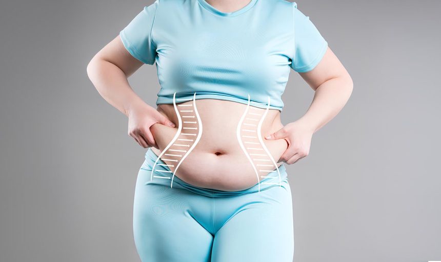 tummy-tuck